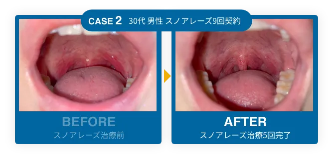 CASE2 before after