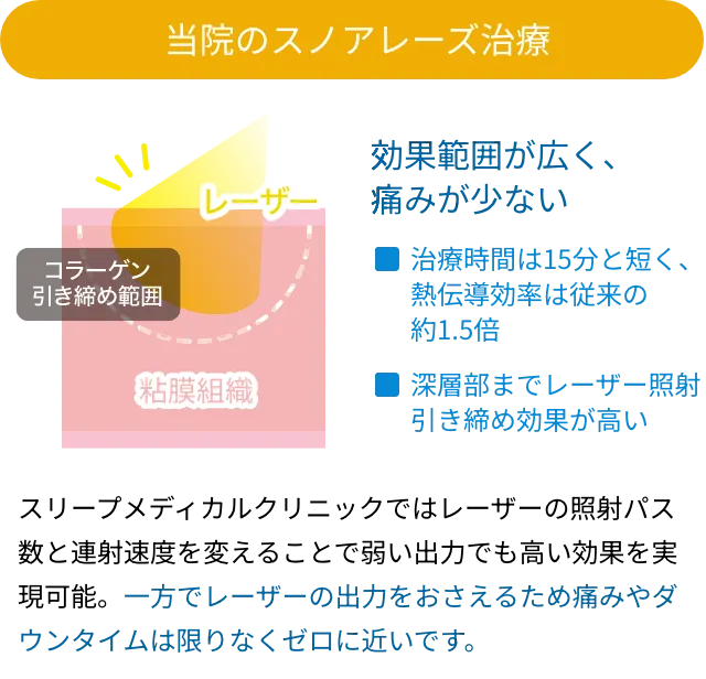 当院のスノアレーズ治療