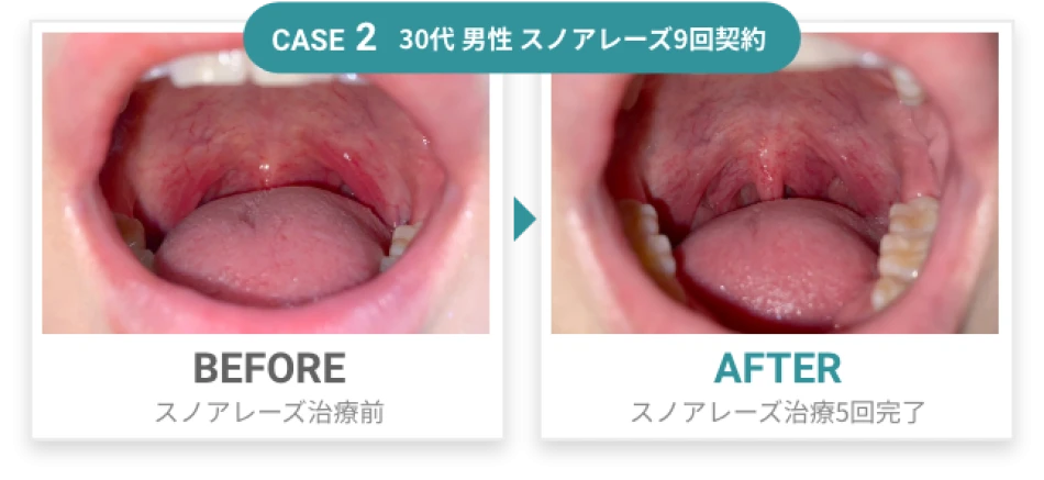 CASE2 before after