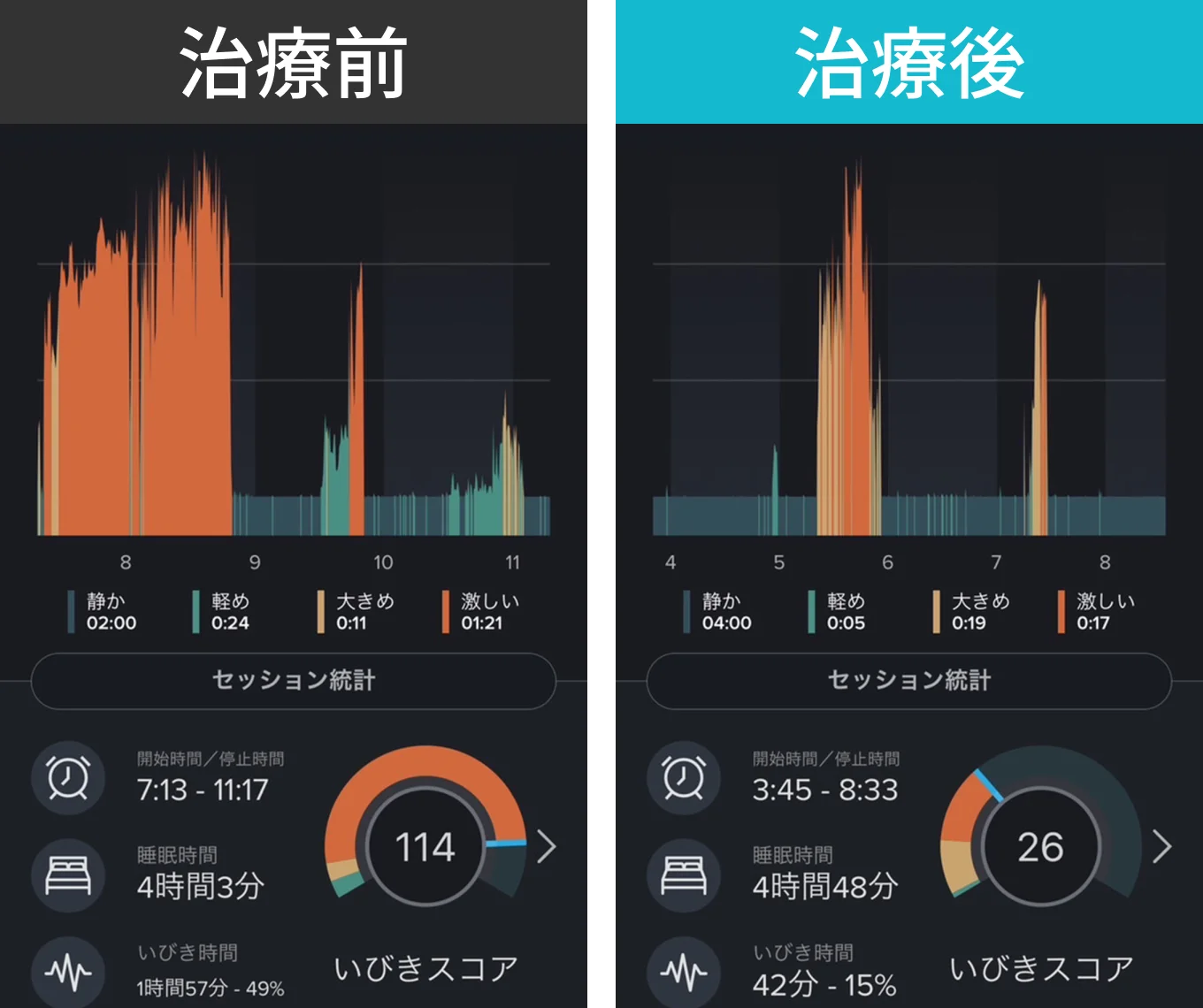 治療前、治療後の比較