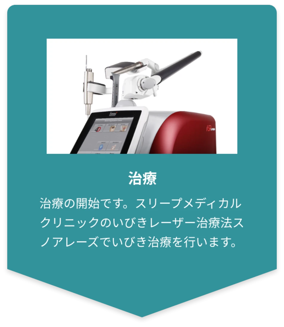 治療　治療の開始です。スリープメディカルクリニックのいびきレーザー治療法スノアレーズでいびき治療を⾏います。