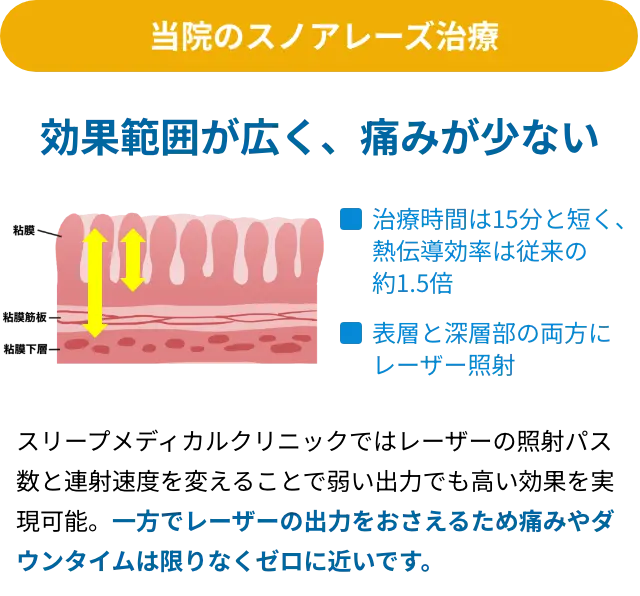 当院のスノアレーズ治療