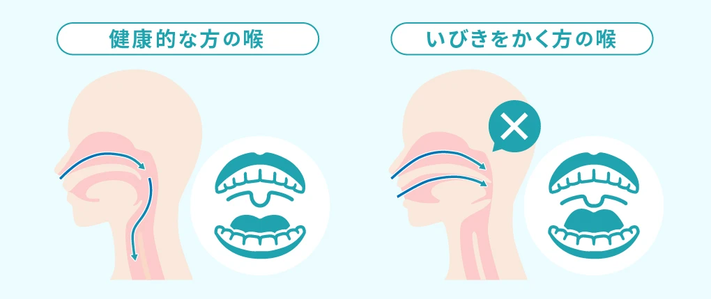 いびきの原因