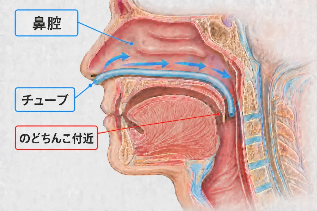 ナステントと鼻腔の断面図イラスト