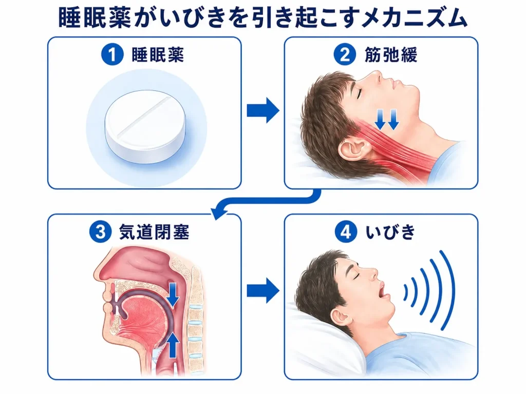 睡眠薬&rarr;筋弛緩&rarr;気道閉塞&rarr;いびきの図解イラスト