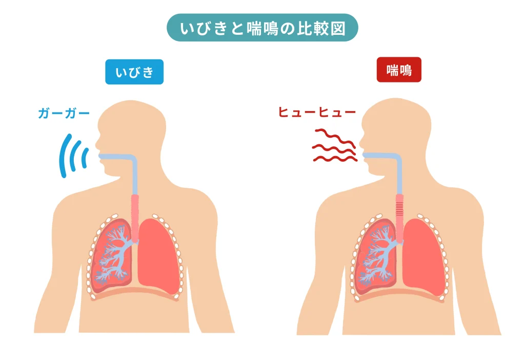 いびきと喘鳴の違いを示した図。いびきは上気道が狭くなることで起こり、喘鳴は気管支など下気道が狭くなることで生じる様子を比較している。