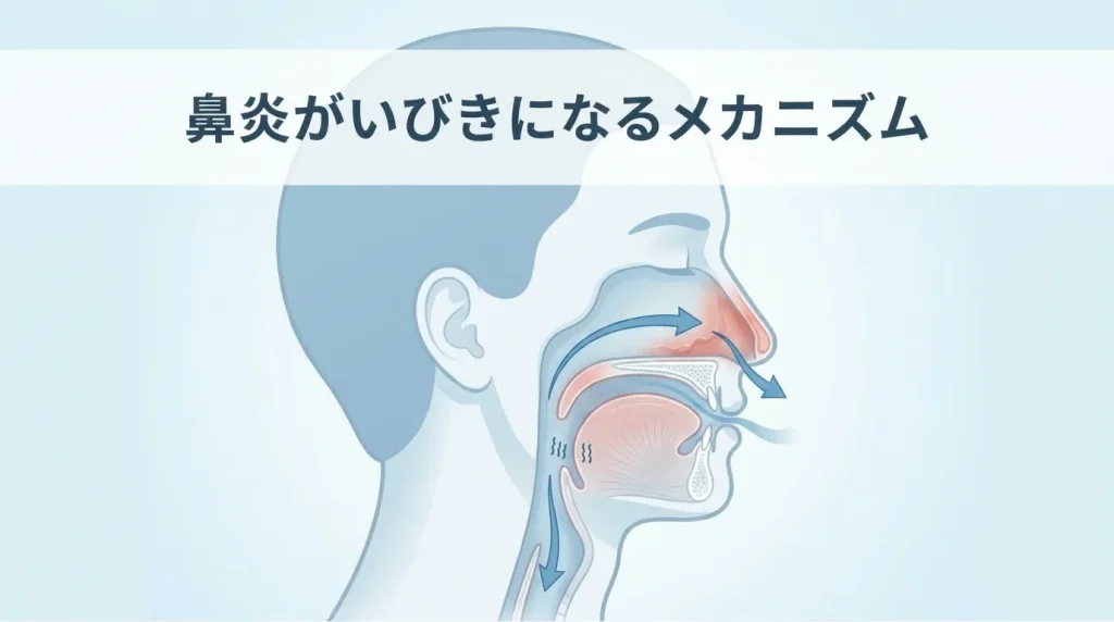 鼻炎や鼻づまりがいびきにつながる仕組みを示した、鼻と気道の断面イラスト