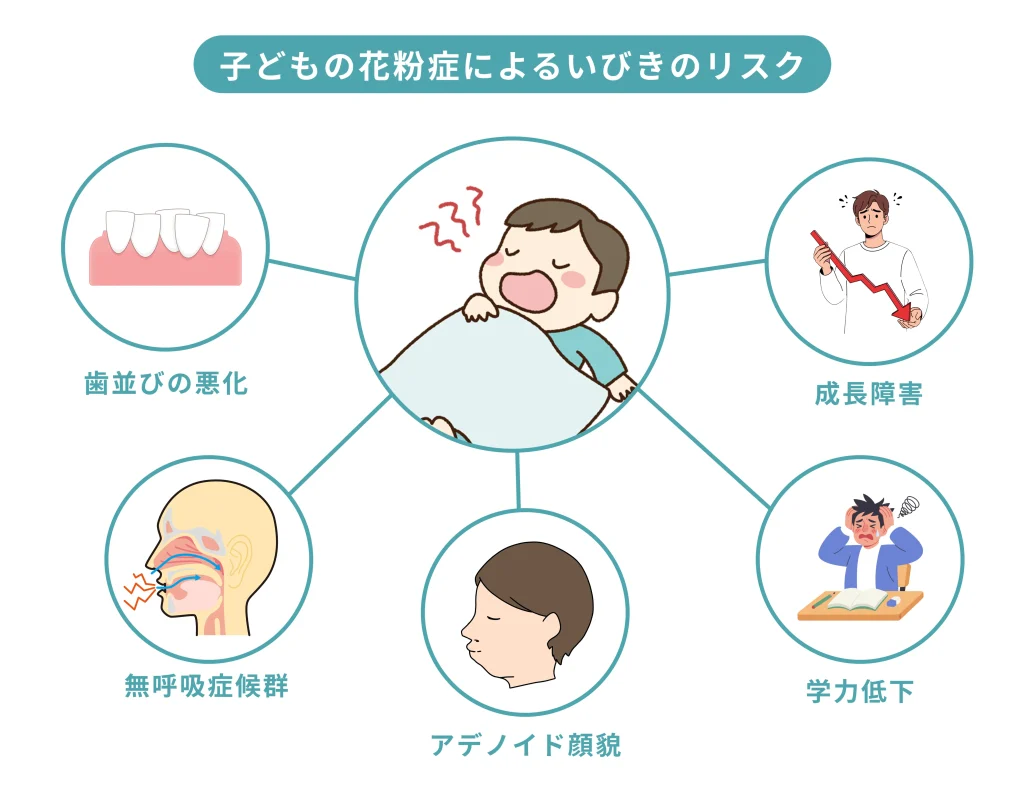 子どもの花粉症によるいびきのリスクを解説した図解。成長障害、学力低下、アデノイド顔貌、歯並びの悪化、睡眠時無呼吸症候群など、見逃せない影響をイラストで示している。