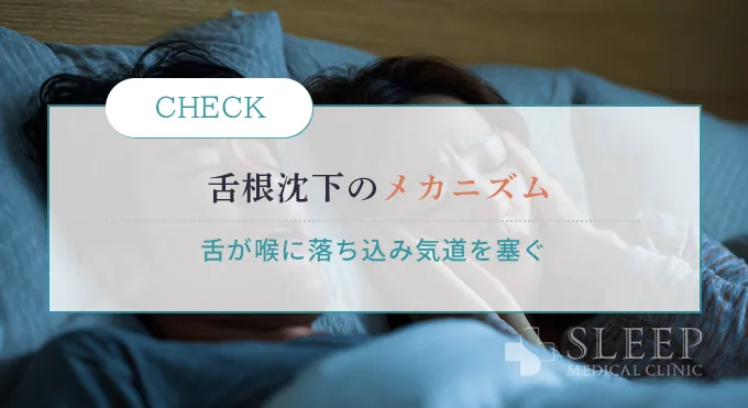 舌根沈下とは？