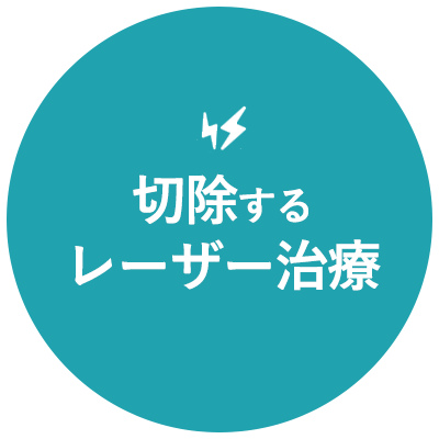 喉の組織や粘膜を切除するレーザー治療